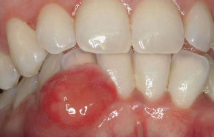 Dermatologie buccale 2026